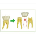 Six Times Anatomy Teeth Model